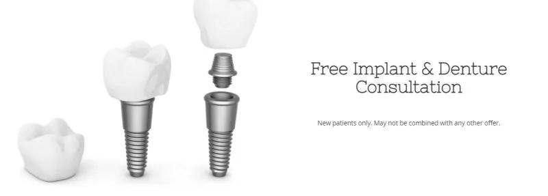 Dental Implant Illustration